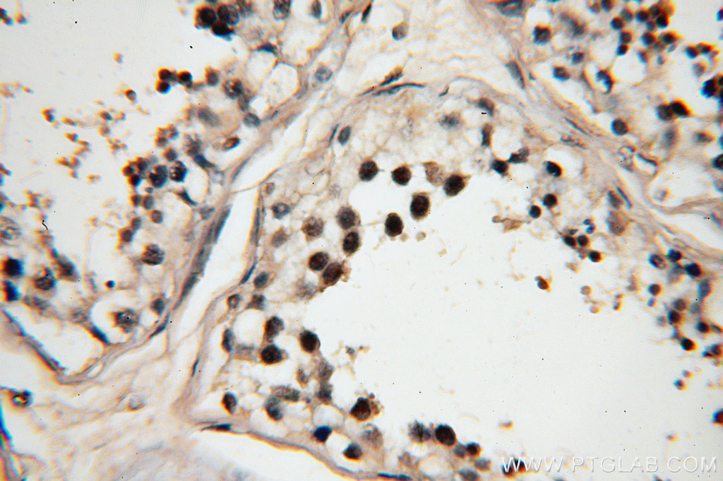 IHC staining of human testis using 18893-1-AP