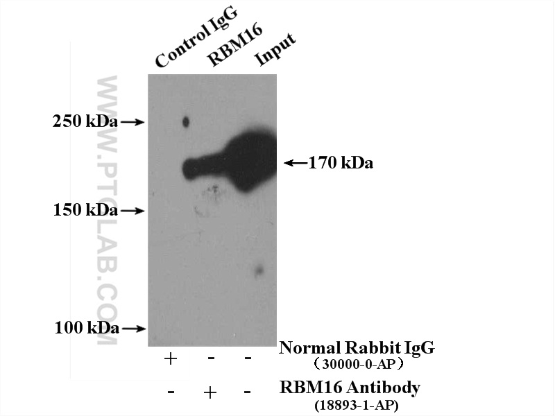 IP experiment of HeLa using 18893-1-AP