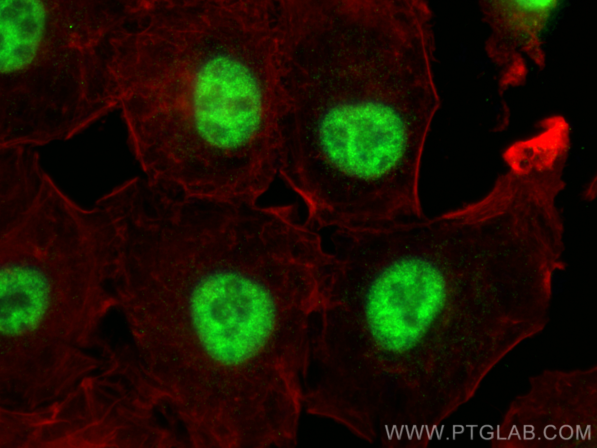 IF Staining of A549 using 13918-1-AP