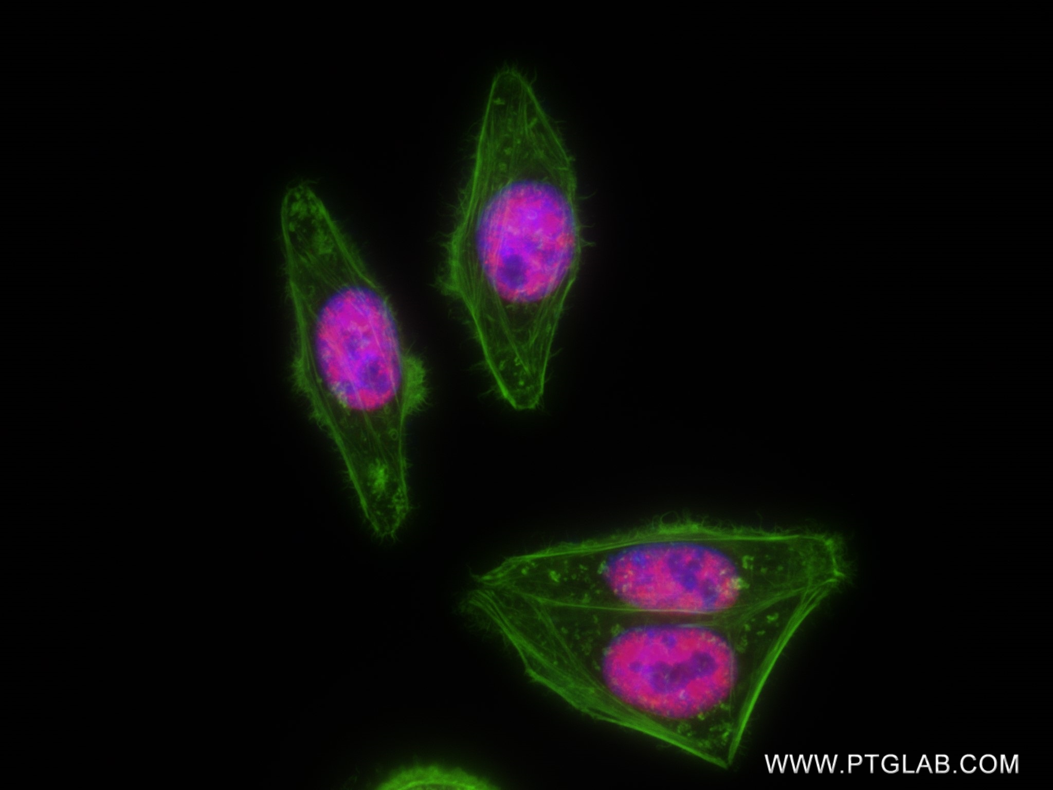 IF Staining of HepG2 using 82889-1-RR (same clone as 82889-1-PBS)