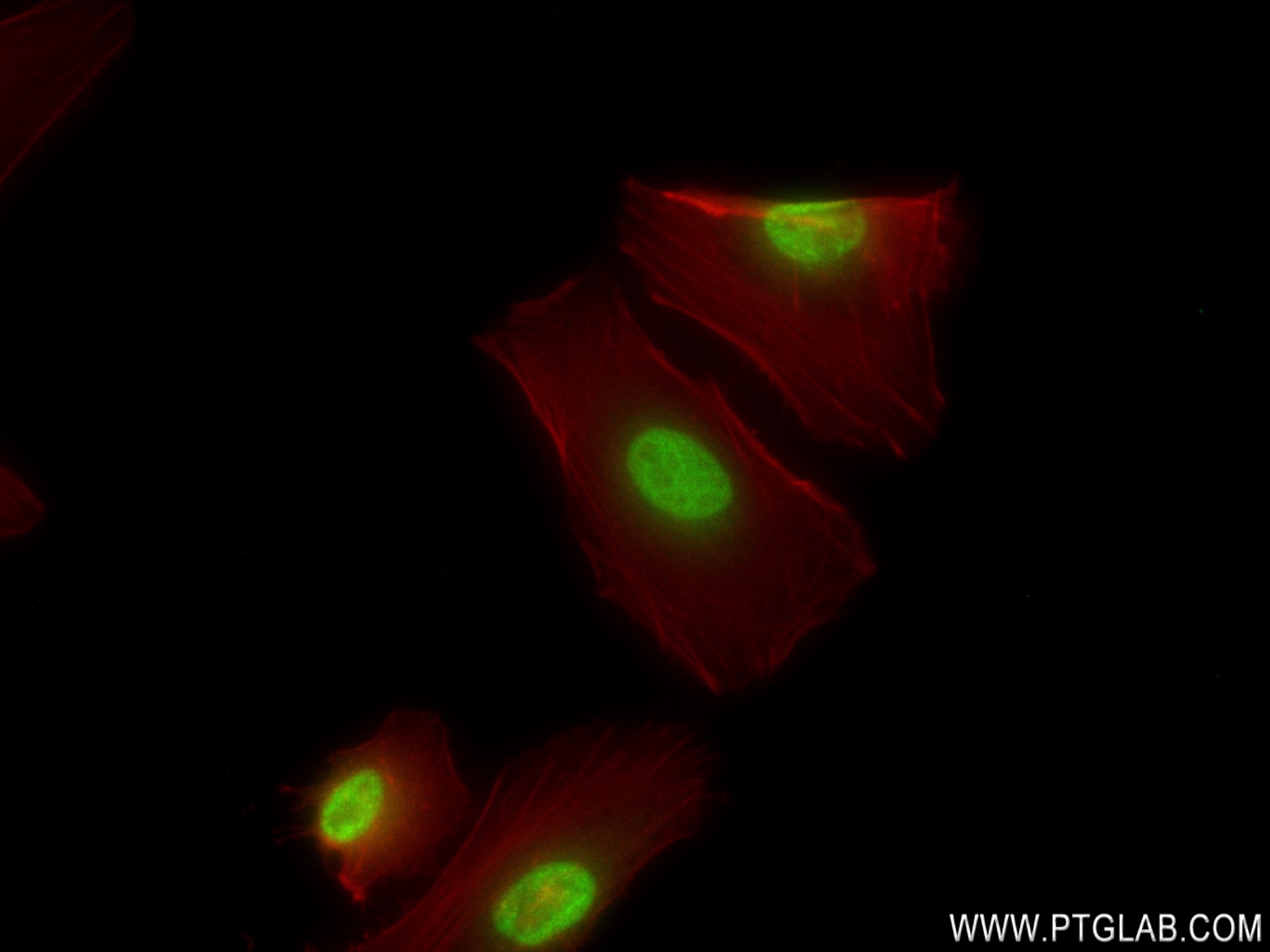 IF Staining of HeLa using 82889-2-RR (same clone as 82889-2-PBS)