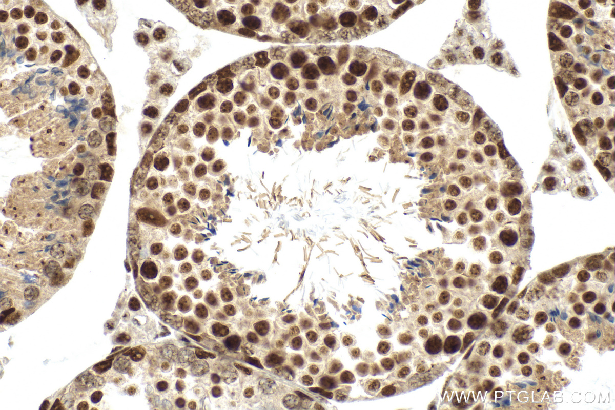 IHC staining of mouse testis using 82889-2-RR (same clone as 82889-2-PBS)