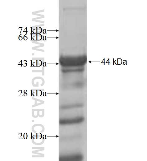 RBM17 fusion protein Ag8278 SDS-PAGE RBM17 fusion protein Ag8278 SDS-PAGE