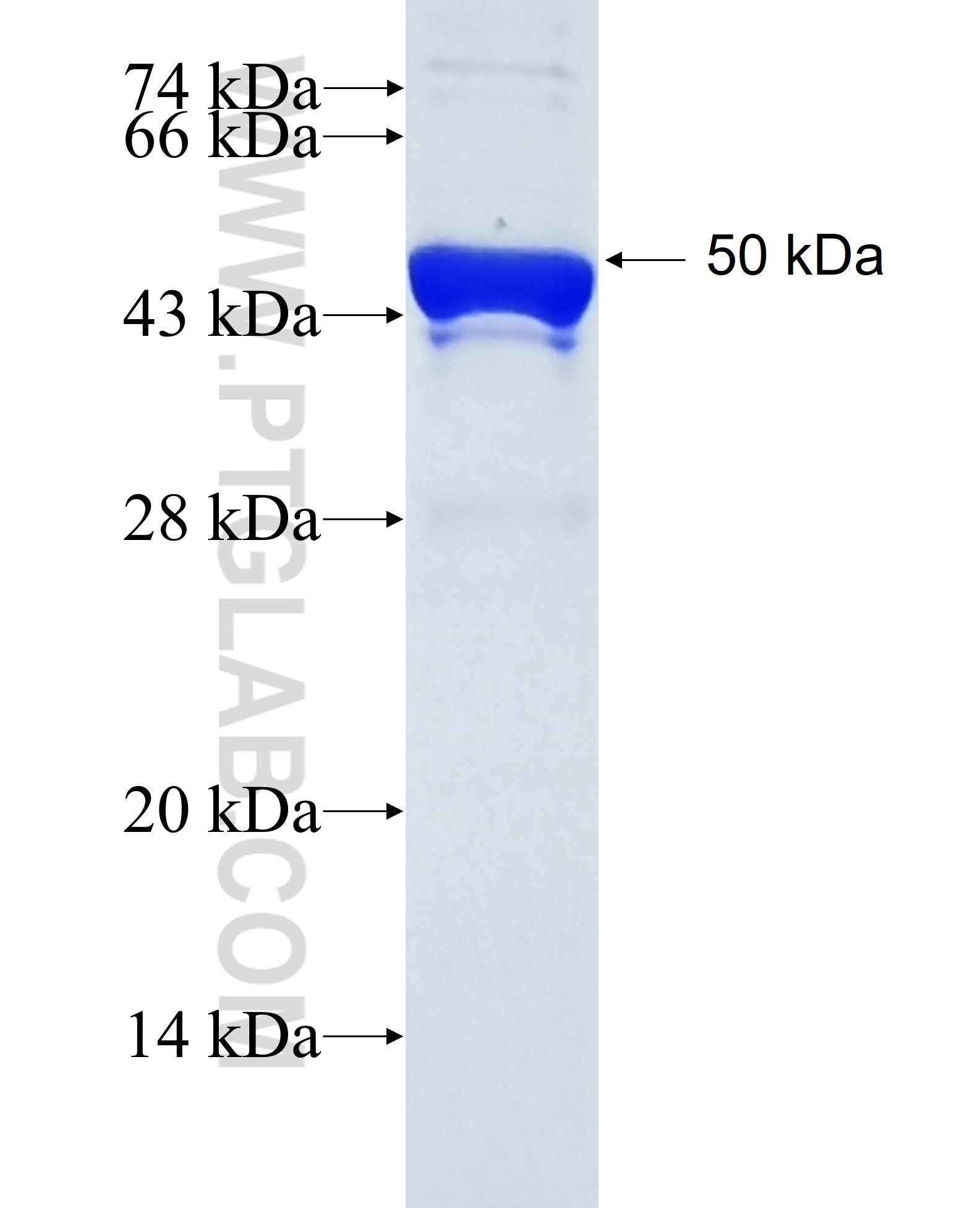 RBM18 fusion protein Ag38618 SDS-PAGE RBM18 fusion protein Ag38618 SDS-PAGE