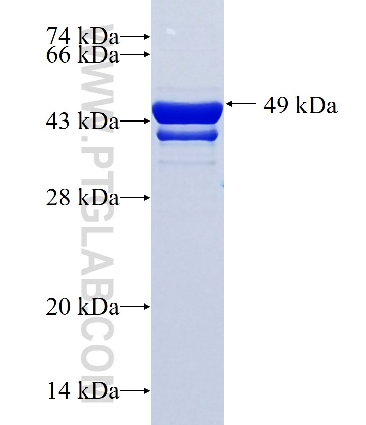 RBM20 fusion protein Ag34322 SDS-PAGE