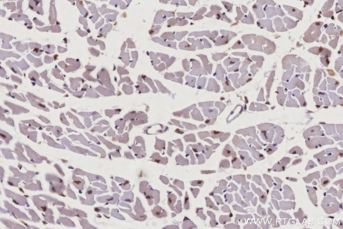 IHC staining of mouse heart using 22103-1-AP IHC staining of mouse heart using 22103-1-AP