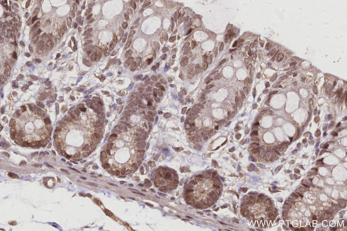 IHC staining of rat colon using 22103-1-AP IHC staining of rat colon using 22103-1-AP