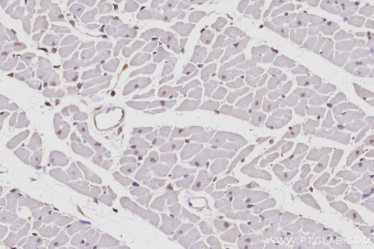 IHC staining of rat heart using 22103-1-AP IHC staining of rat heart using 22103-1-AP