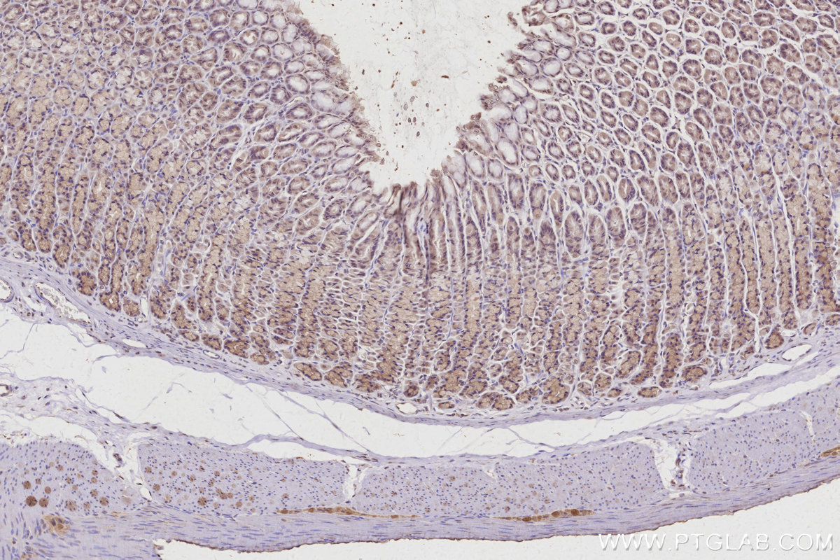 IHC staining of rat stomach using 22103-1-AP