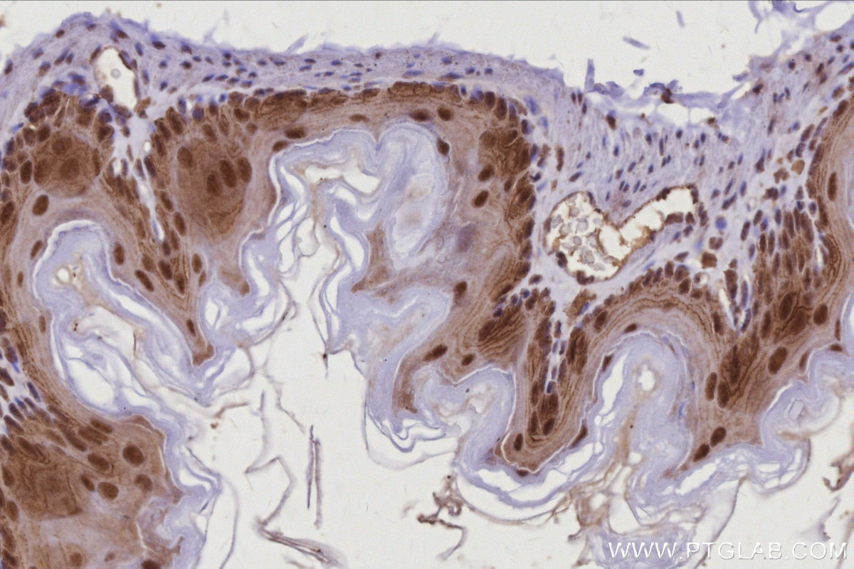 IHC staining of mouse stomach using 22103-1-AP IHC staining of mouse stomach using 22103-1-AP