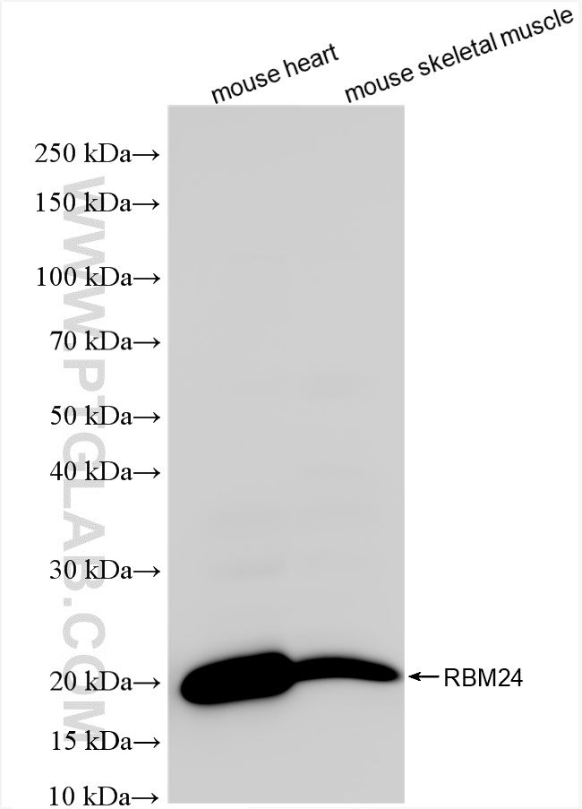WB analysis using 85674-1-RR