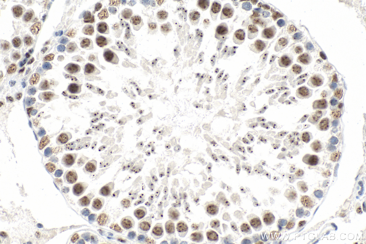 IHC staining of rat testis using 25297-1-AP IHC staining of rat testis using 25297-1-AP