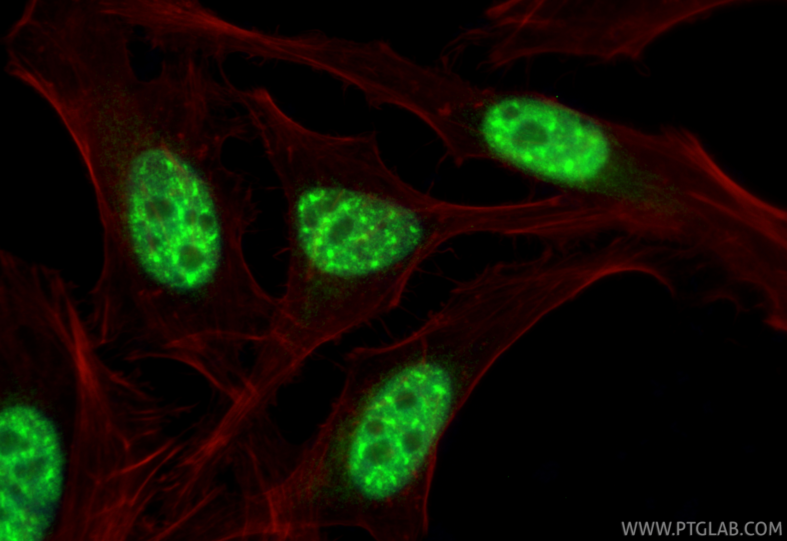 IF Staining of HeLa using RMX00066