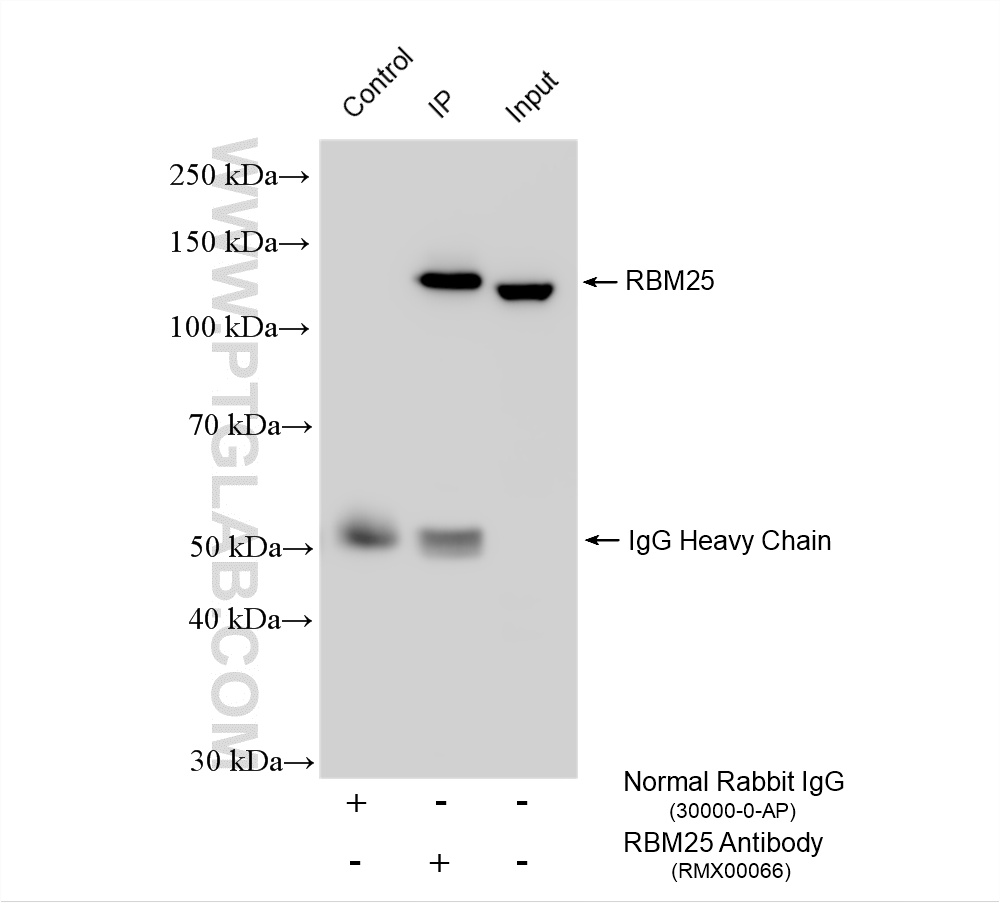 IP experiment of HEK-293 using RMX00066