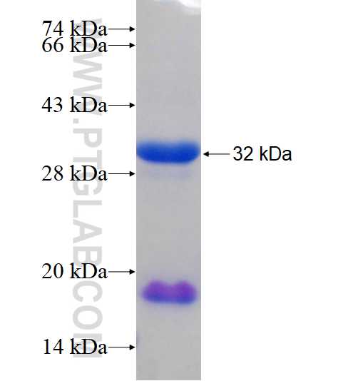 RBM25 fusion protein Ag18467 SDS-PAGE RBM25 fusion protein Ag18467 SDS-PAGE