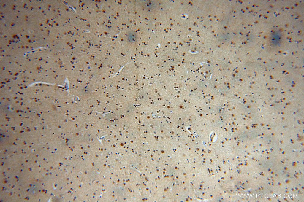 IHC staining of human brain using 16823-1-AP