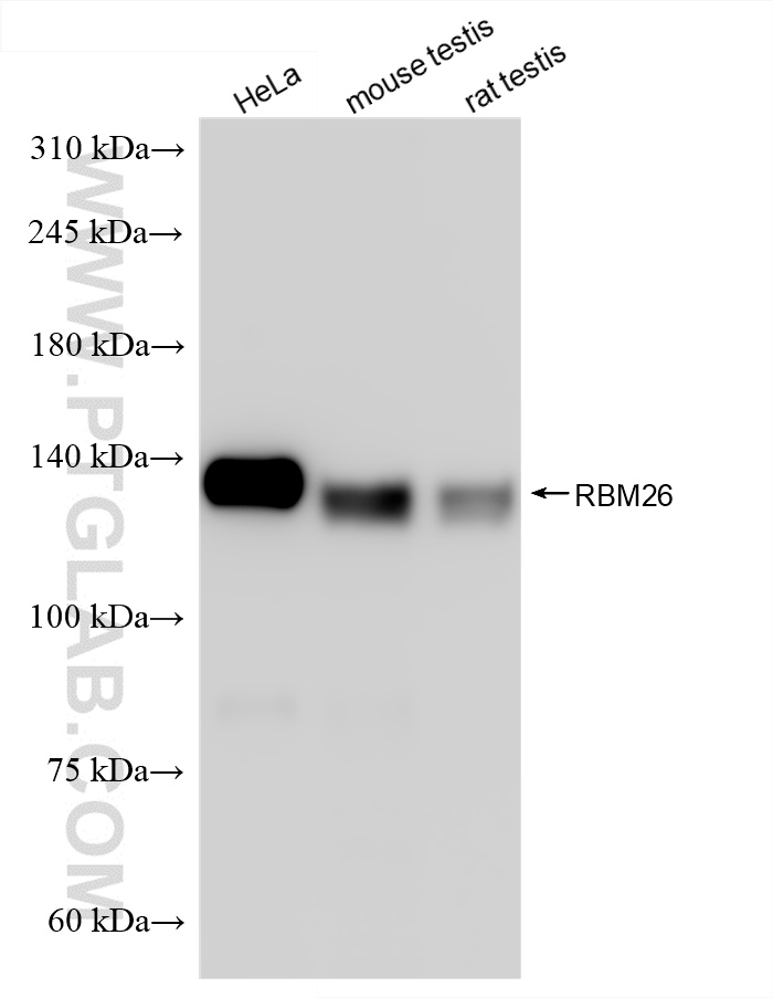 WB analysis using 86302-1-RR