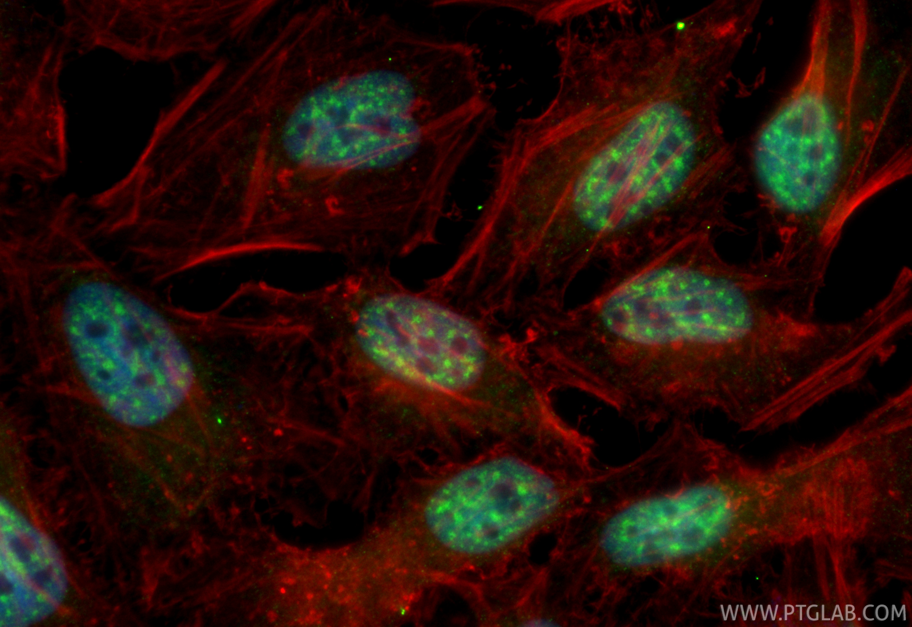 IF Staining of HeLa using CL488-86302