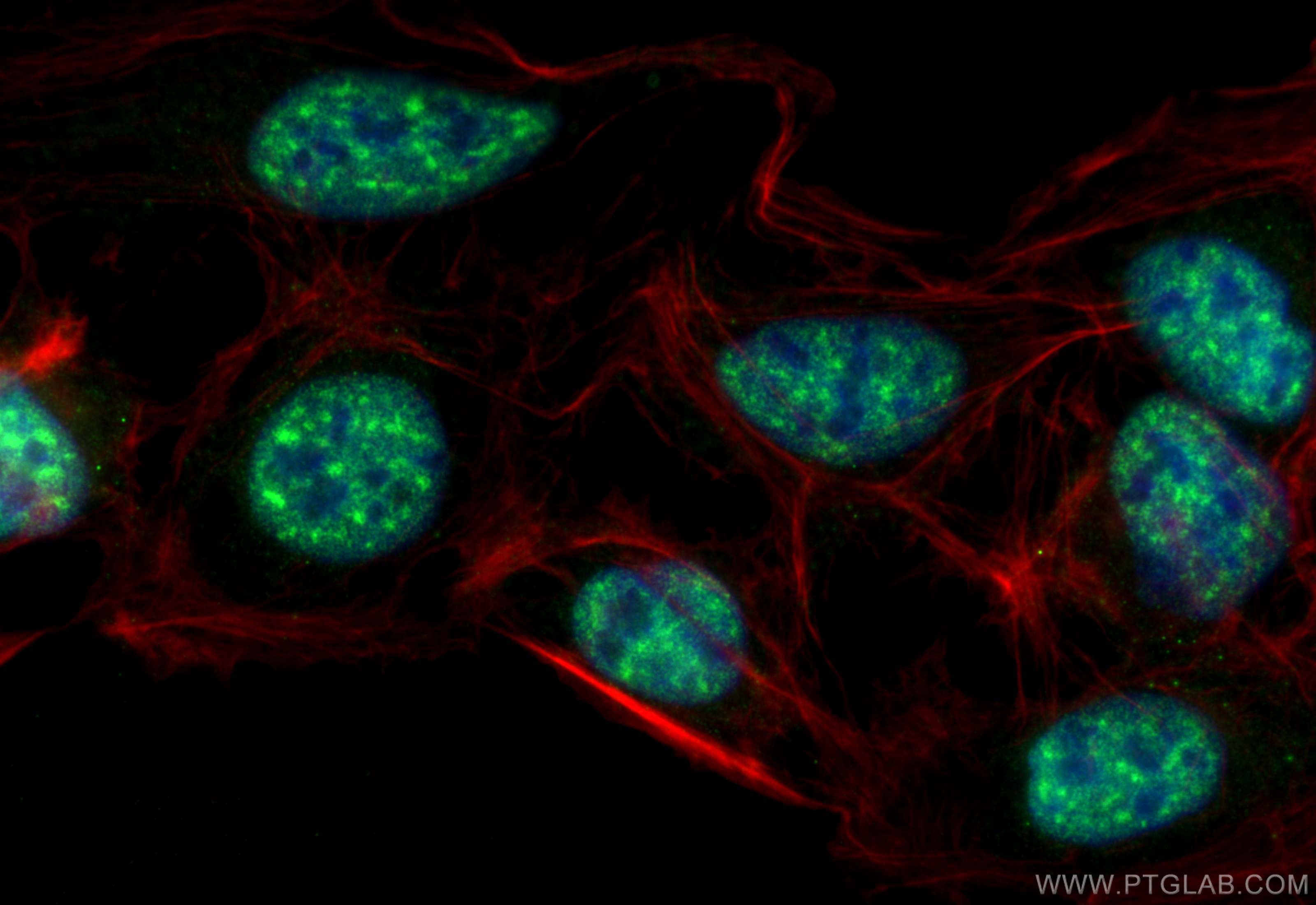 IF Staining of U2OS using 31850-1-AP