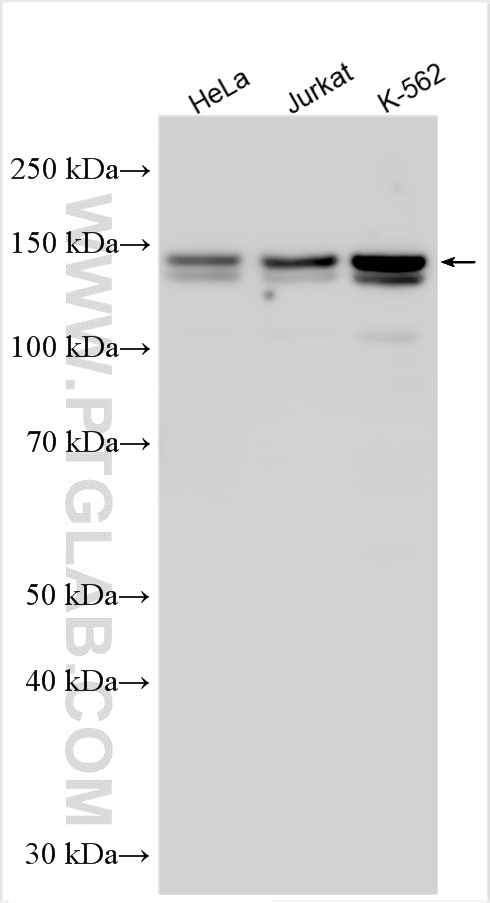 WB analysis using 31850-1-AP