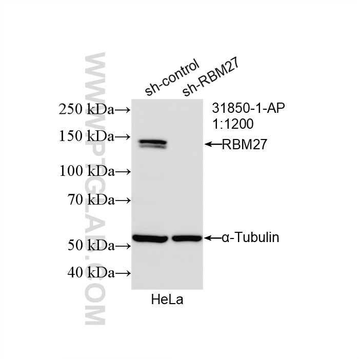 WB analysis of HeLa using 31850-1-AP