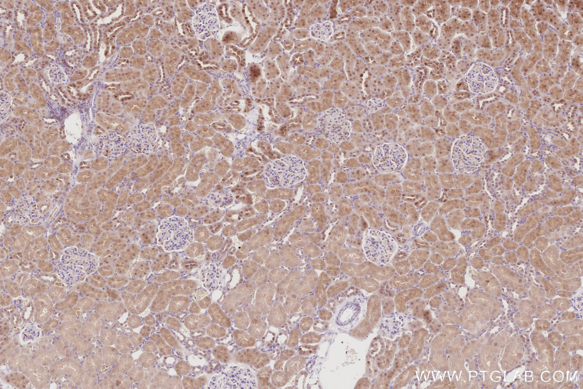 IHC staining of rat kidney using 16435-1-AP IHC staining of rat kidney using 16435-1-AP