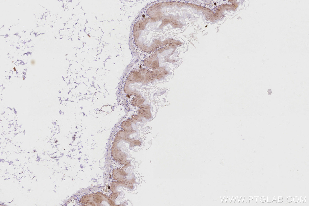 IHC staining of mouse stomach using 16435-1-AP IHC staining of mouse stomach using 16435-1-AP