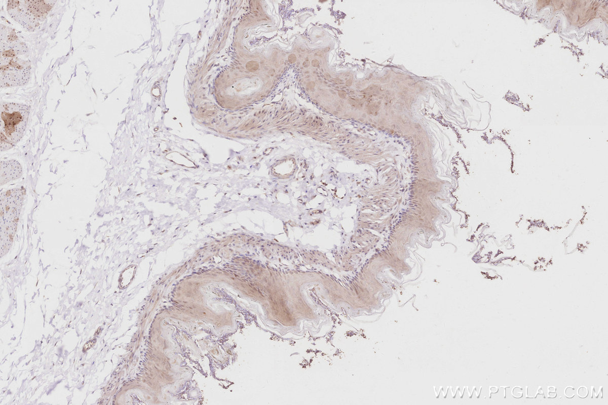 IHC staining of rat stomach using 16435-1-AP IHC staining of rat stomach using 16435-1-AP