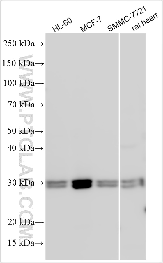 WB analysis using 16435-1-AP