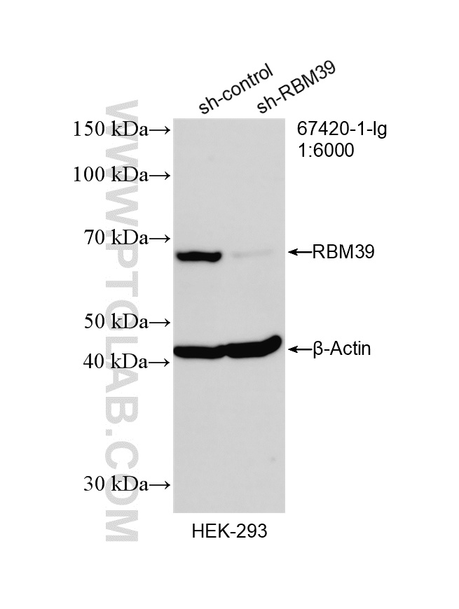 WB analysis of HEK-293 using 67420-1-Ig