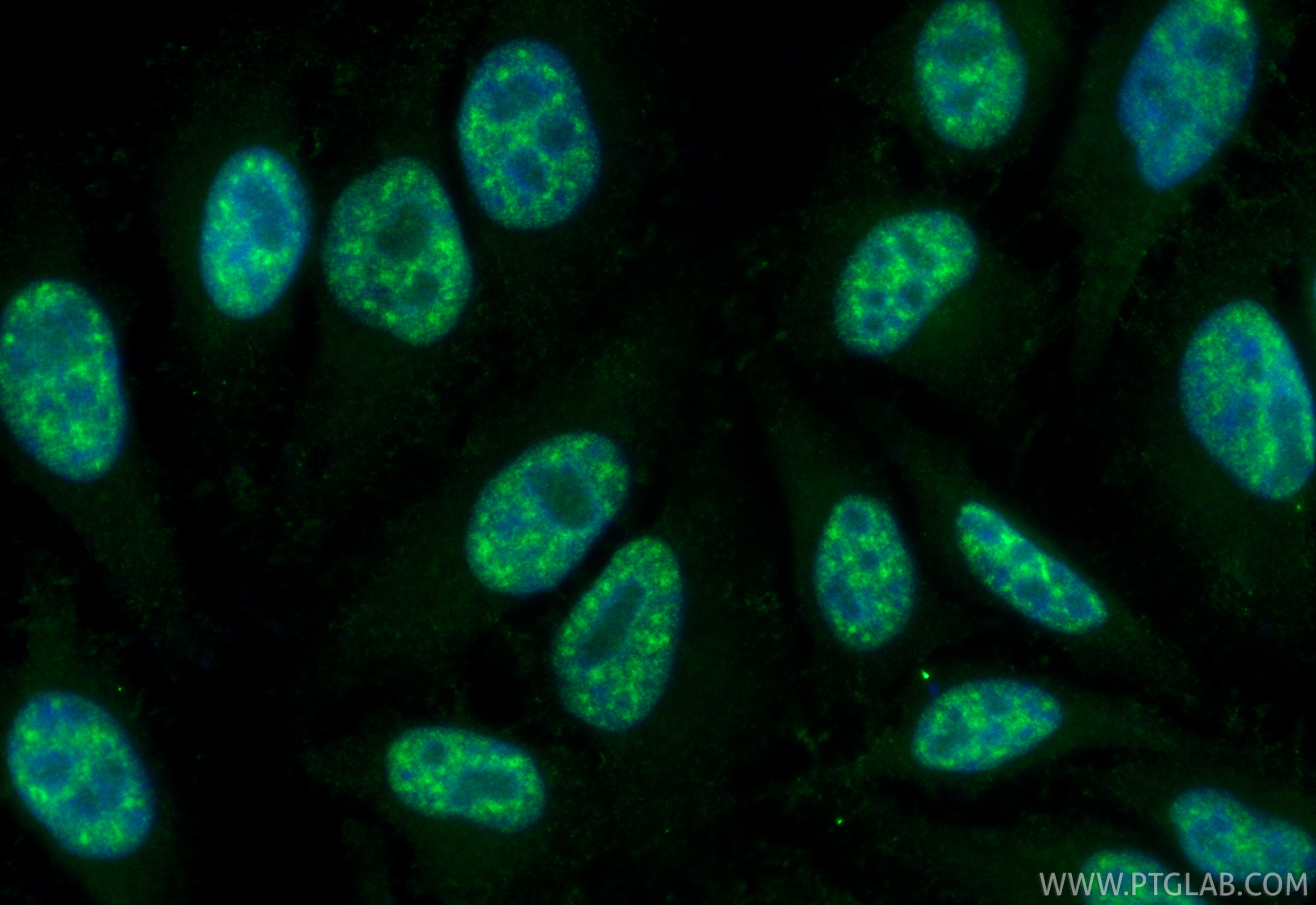 IF Staining of HepG2 using CL488-67420