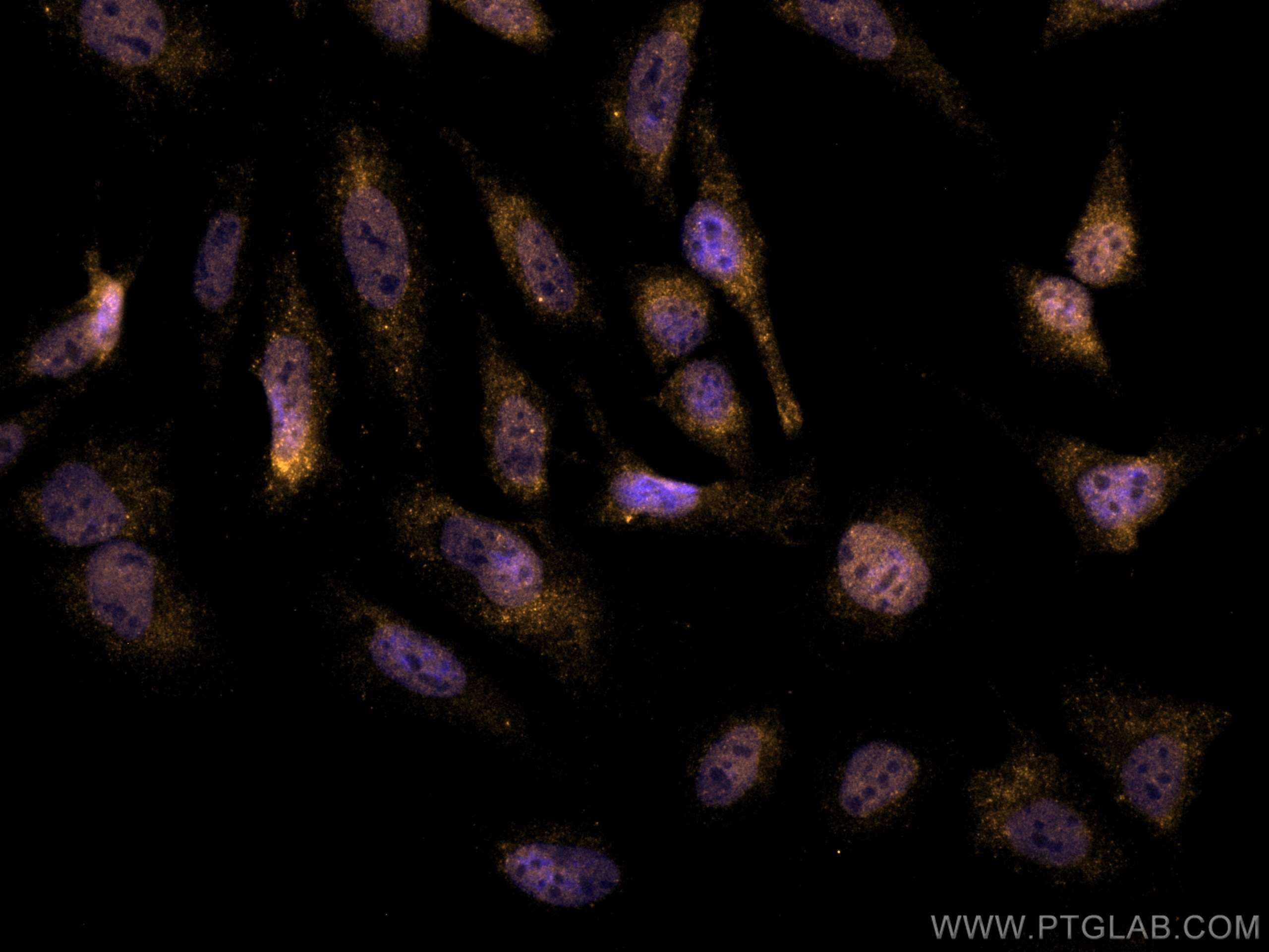 IF Staining of HeLa using CL555-60292