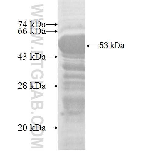 RBM41 fusion protein Ag8798 SDS-PAGE