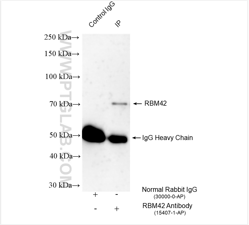 IP experiment of HepG2 using 15407-1-AP