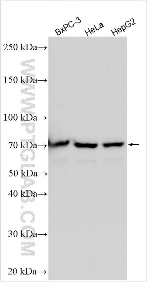 Various lysates were subjected to SDS PAGE followed by western blot with 15407-1-AP (RBM42 antibody) at dilution of 1:1000 incubated at room temperature for 1.5 hours. WB analysis using 15407-1-AP