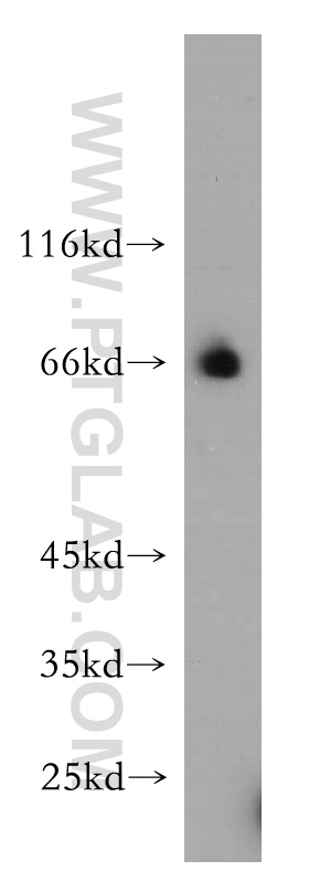 WB analysis of HepG2 using 15407-1-AP