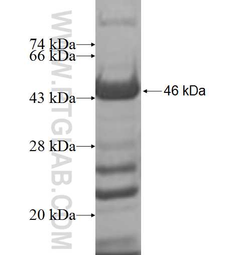 RBM42 fusion protein Ag7418 SDS-PAGE