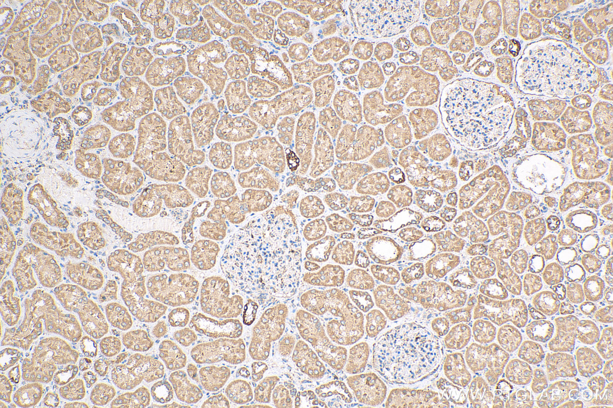 IHC staining of human kidney using 24368-1-AP