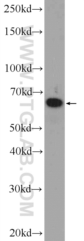 WB analysis of A549 using 23902-1-AP