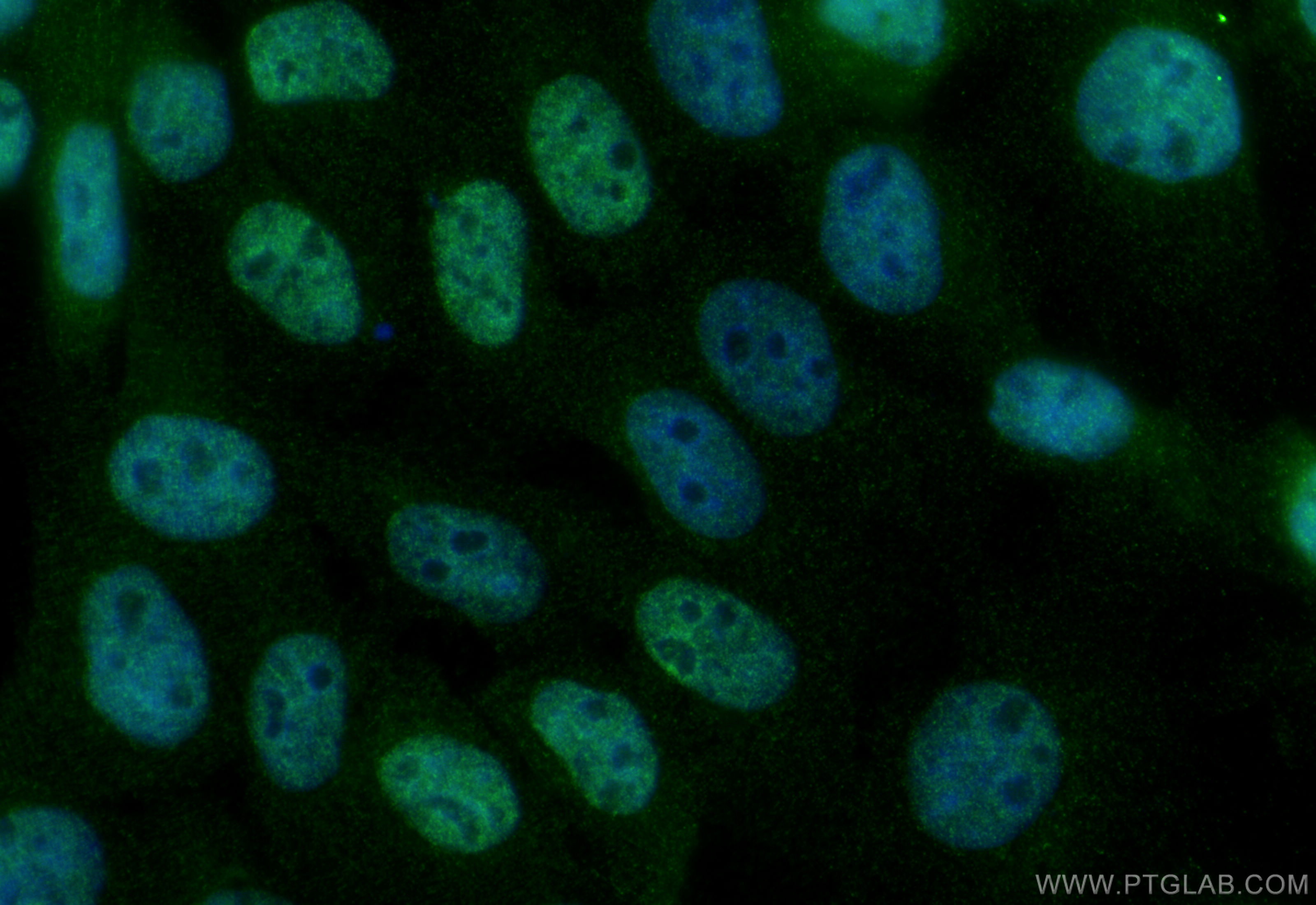 IF Staining of A431 using 28307-1-AP (same clone as 28307-1-PBS) IF Staining of A431 using 28307-1-AP (same clone as 28307-1-PBS)