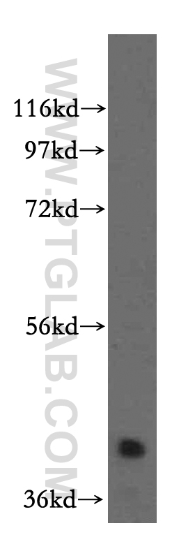 WB analysis of HEK-293 using 15412-1-AP