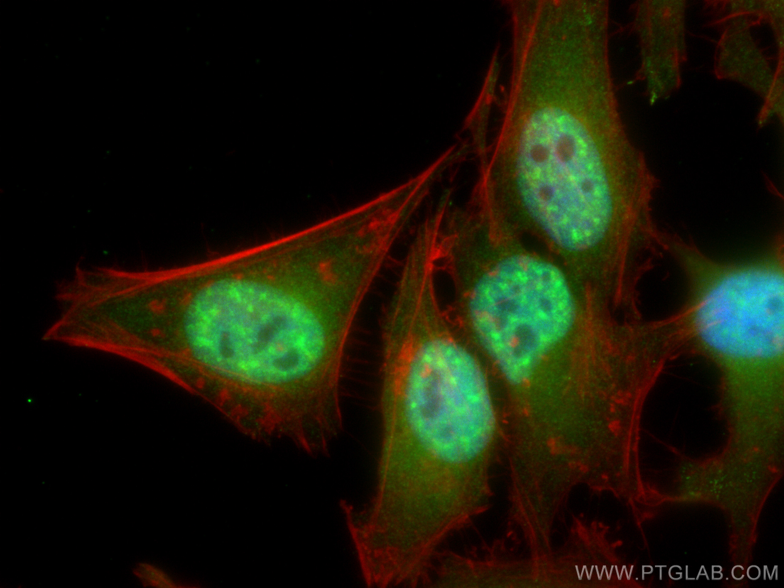 IF Staining of HeLa using 14958-1-AP