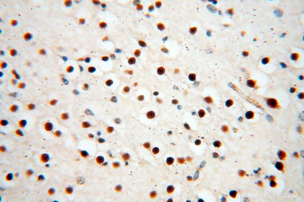 IHC staining of human brain using 14958-1-AP