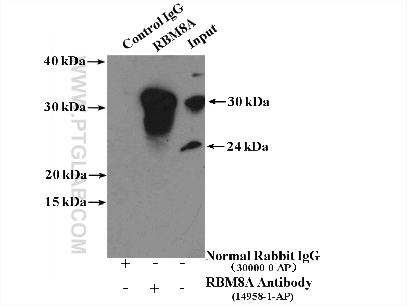 IP experiment of HeLa using 14958-1-AP