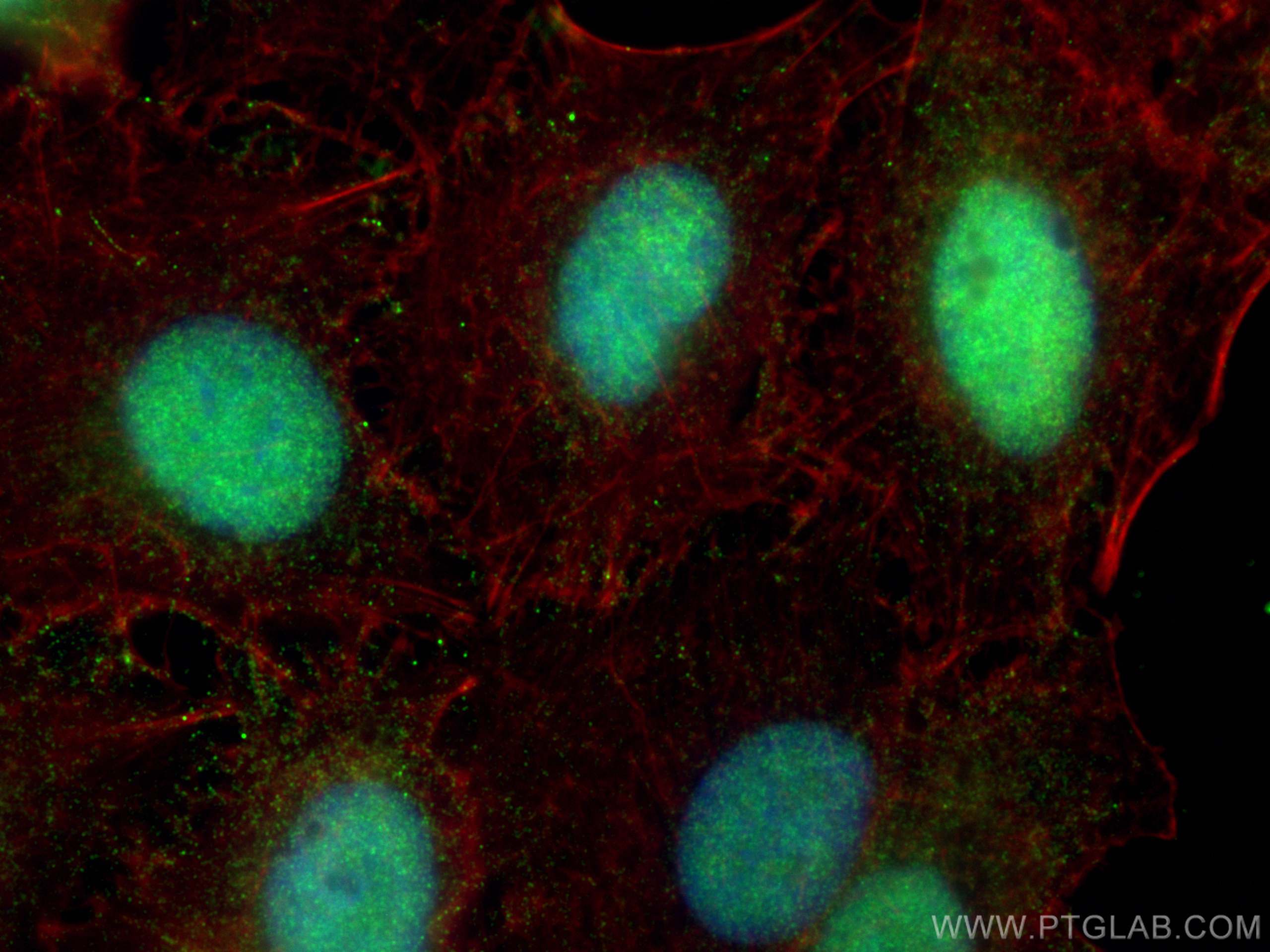 IF Staining of A549 using 67541-1-Ig