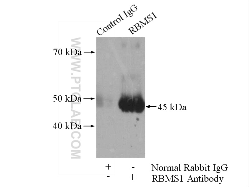 IP experiment of HeLa using 11061-2-AP