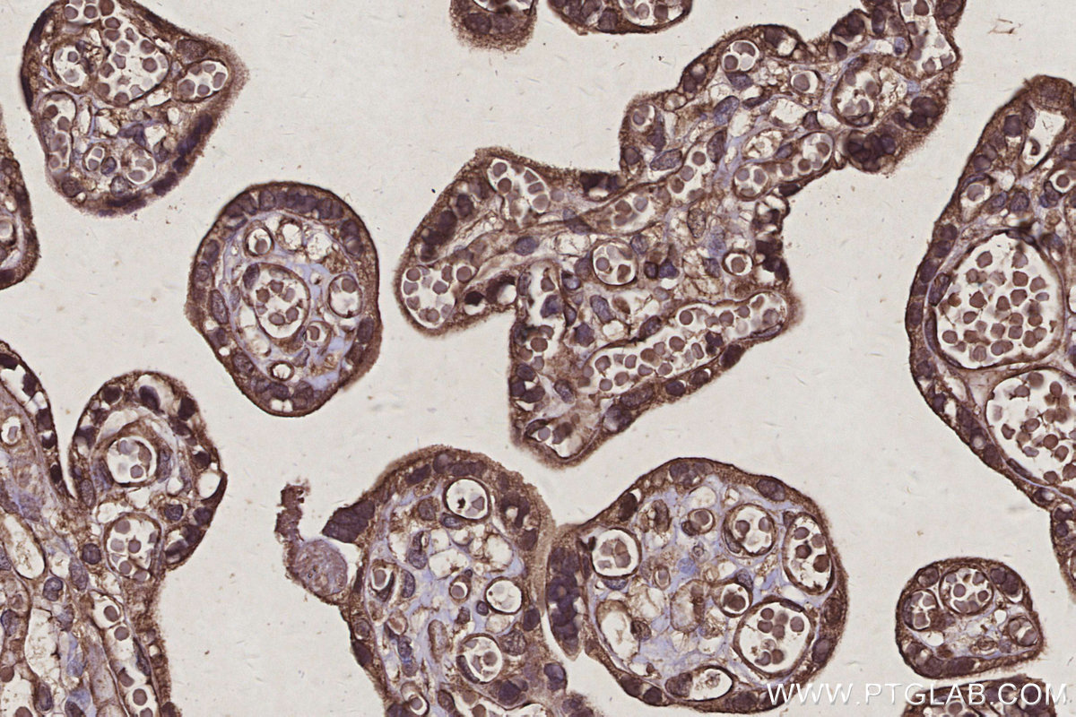 IHC staining of human placenta using 67395-1-Ig IHC staining of human placenta using 67395-1-Ig