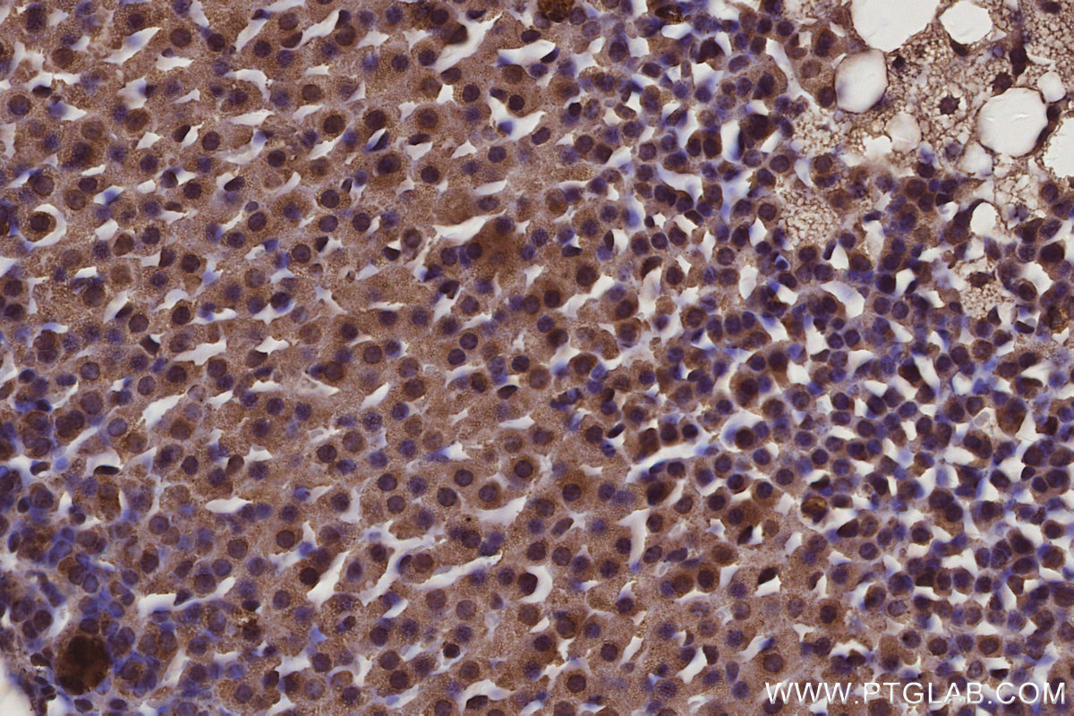 IHC staining of mouse adrenal gland using 67395-1-Ig IHC staining of mouse adrenal gland using 67395-1-Ig
