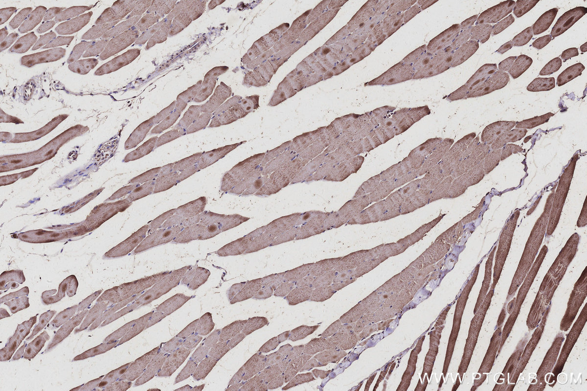 IHC staining of mouse skeletal muscle using 67395-1-Ig IHC staining of mouse skeletal muscle using 67395-1-Ig