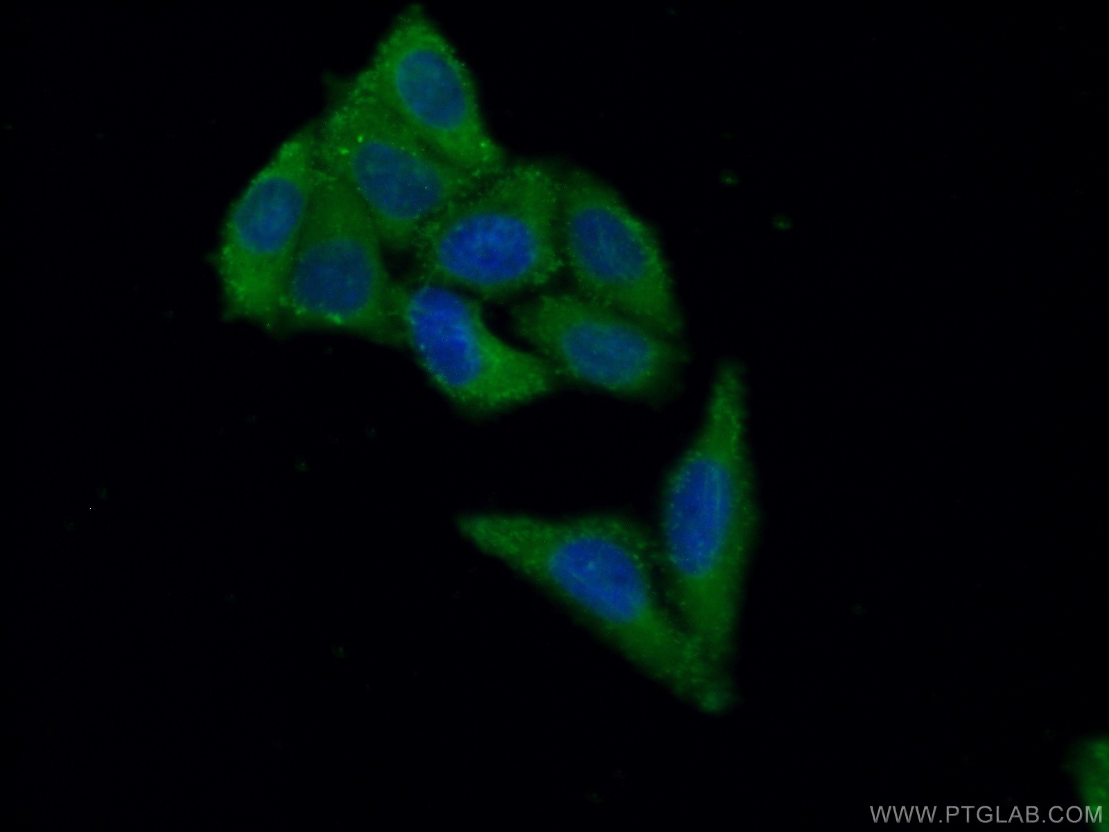 IF Staining of HepG2 using 17994-1-AP